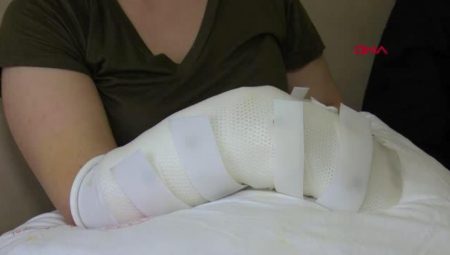 Zelzeleden 33 saat sonra enkazdan yaralı olarak kurtarılan üniversiteli Sude’den haber alınamıyor