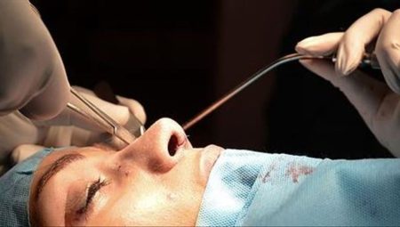 Estetik artık gençlerin tercihi: Yaş 18’in altına indi