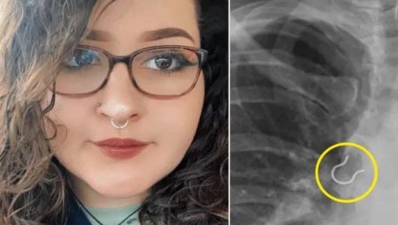 Köpek tüyü sandı, gerçek röntgende çıktı! Bakın ne yutmuş…